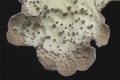 Lobaria scrobiculata