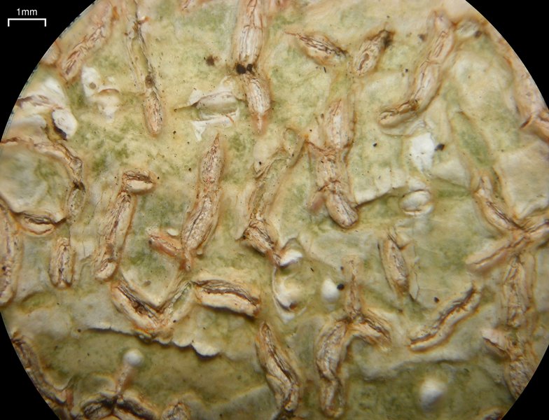 Acanthothecis peplophora