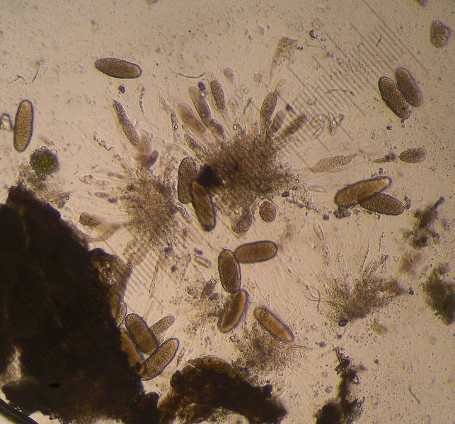 Agonimia tristicula