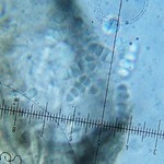 Arthonia albopulverea
