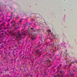 Biatoropsis usnearum
