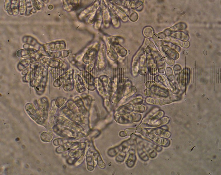 Cheiromycina flabelliformis