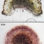 Dactylospora athallina