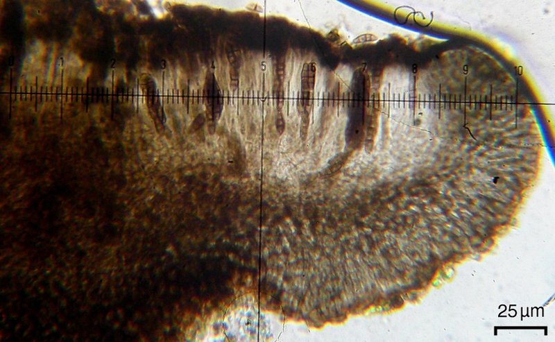 Dactylospora parasitica