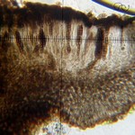 Dactylospora parasitica