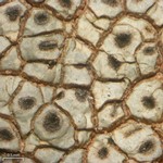 Diploschistes actinostomus