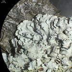 Imshaugia placorodia