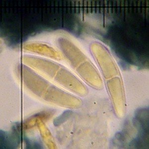 Lecania naegelii
