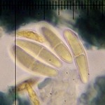 Lecania naegelii