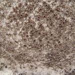 Lecanora allophana