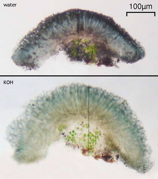 Lecidea leprarioides