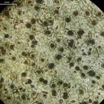 Lecidella enteroleucella