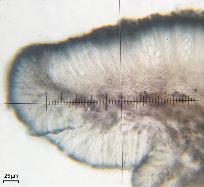 Lecidella patavina