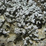 Lepraria albicans