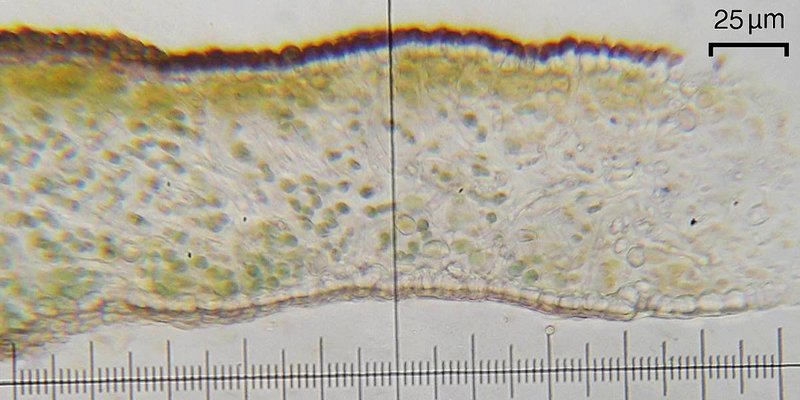 Leptogium intermedium