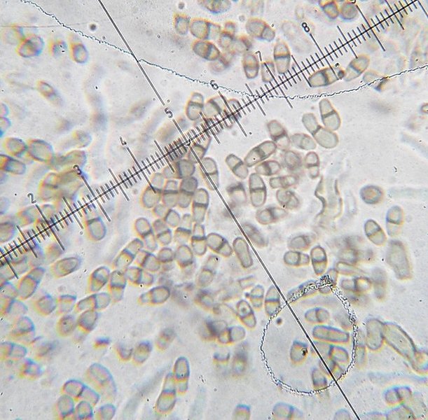 Lichenodiplis lecanorae
