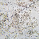 Lichenodiplis lecanorae