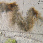 Lichenodiplis lecanorae