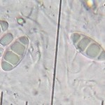 Lithothelium hyalosporum