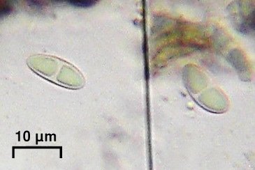 Megalaria columbiana