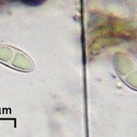 Megalaria columbiana