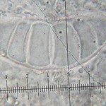 Megalospora pachycheila