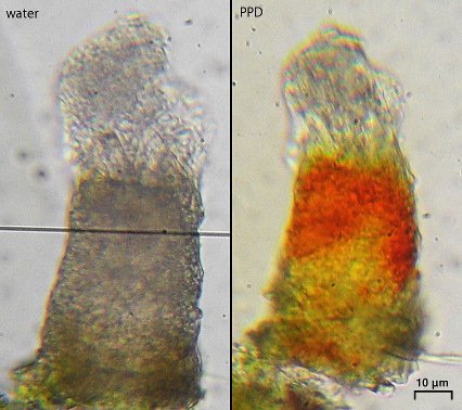 Micarea neostipitata