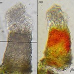 Micarea neostipitata