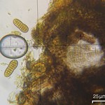 Mycoporum pycnocarpoides