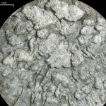 Pertusaria albescens