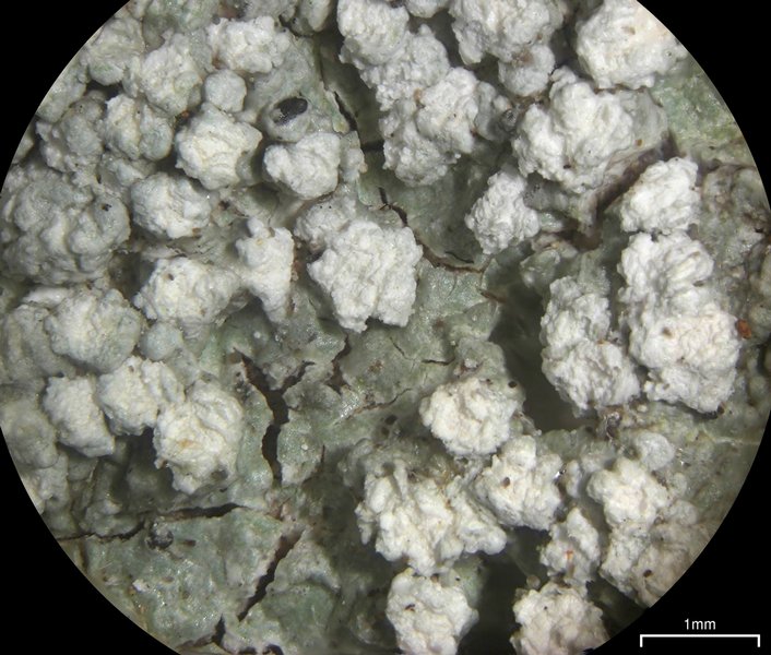 Pertusaria amara