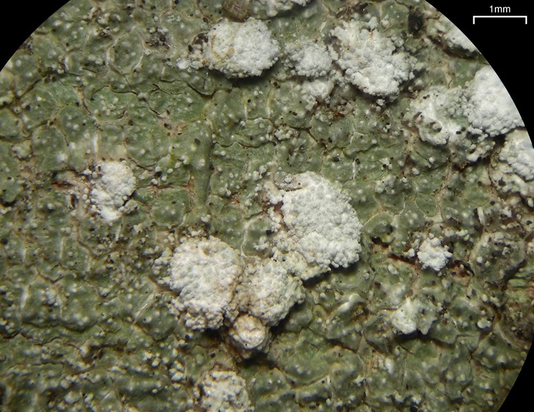 Pertusaria amara