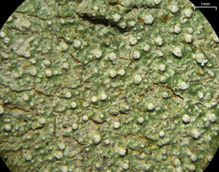 Pertusaria amara