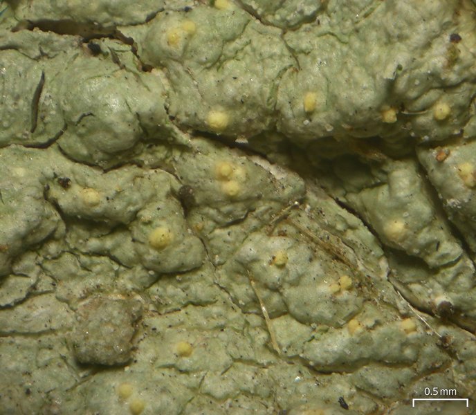Pertusaria epixantha