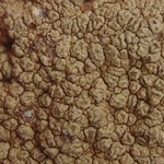 Pertusaria flavicunda