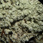Pertusaria globularis