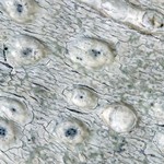 Pertusaria leioplaca