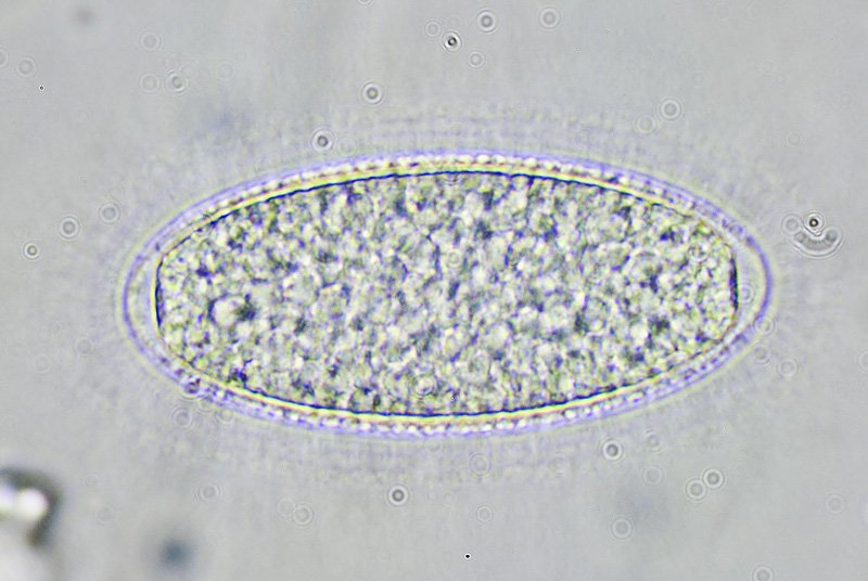 Pertusaria leioplaca
