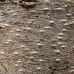 Pertusaria leioplaca