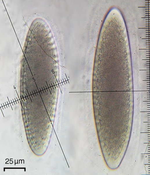 Pertusaria macounii