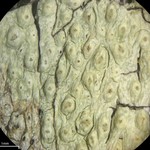 Pertusaria xanthodes