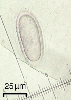 Pertusaria xanthodes