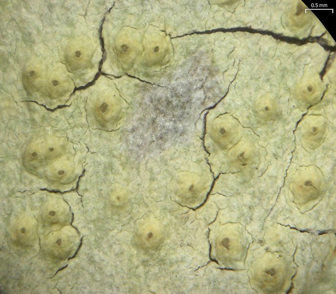 Pertusaria xanthodes