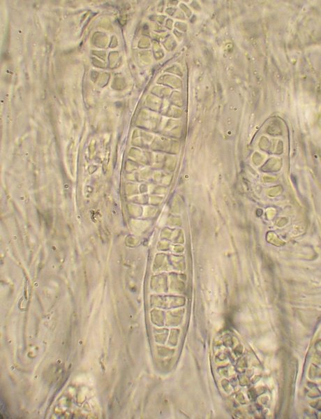 Protothelenella sphinctrinoides