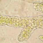 Psoroglaena stigonemoides