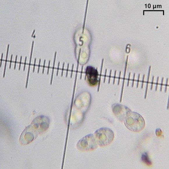 Pyrenocollema prospersellum