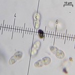 Pyrenocollema prospersellum