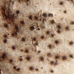 Pyrenula microtheca