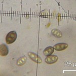 Pyrenula pseudobufonia