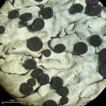 Pyxine berteriana